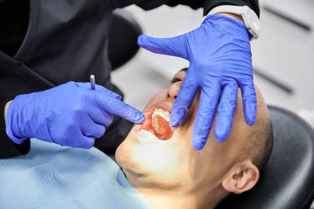Best After-Hours Emergency Dentist in Cedar Ridge, CA