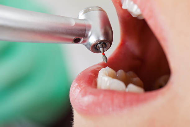 Best Pediatric Emergency Dentist in Cedar Ridge, CA